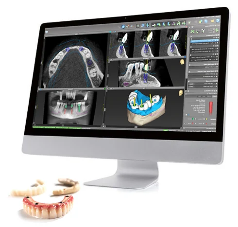 Image highlighting the advanced technology used by top dentists in Puerto Vallarta.