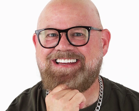 Picture highlighting the All-on-4 dental implant procedure available in Mexico.