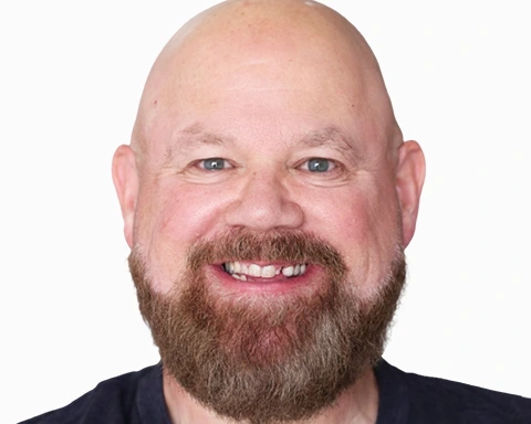 All-on-4 dental implants offered in Mexican clinics.