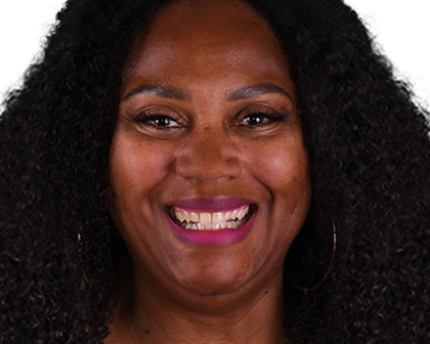 Close-up of All-on-4 dental implants post-procedure in Mexico.