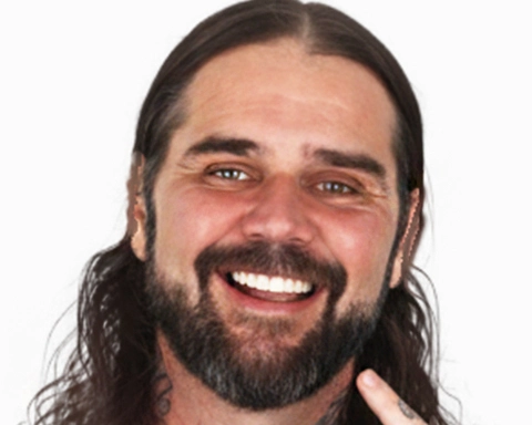 All-on-4 dental implants in Mexico, demonstrating the aesthetic and functional benefits.