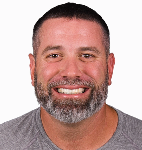 Before and after results of cosmetic dentistry, showing significant smile improvements at a Puerto Vallarta clinic.